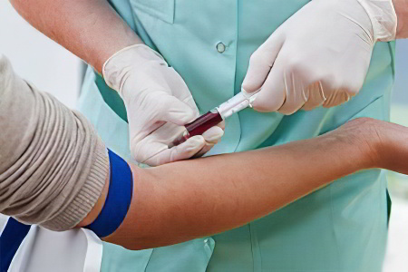 Гамма-глютамилтранспептидаза Гамма-глютамилтранспептидаза