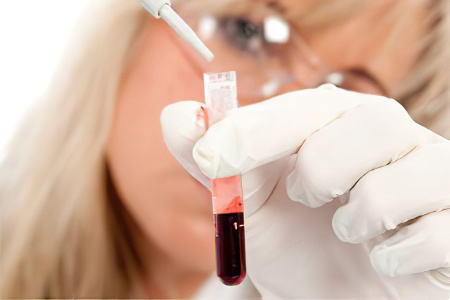 Анализ крови на кальцитонин Анализ крови на кальцитонин