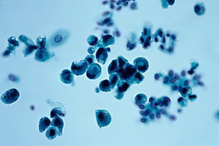 Лейкоциты и эритроциты по Нечипоренко Лейкоциты и эритроциты по Нечипоренко