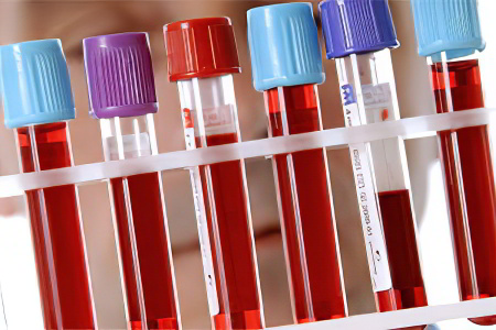 Анемия 1 степени Анемия 1 степени