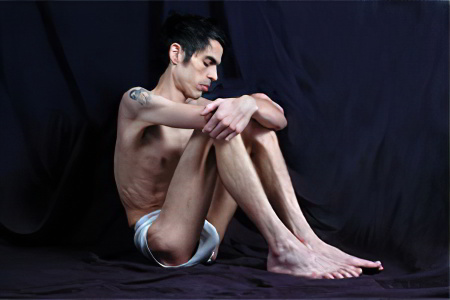 Анорексия Анорексия