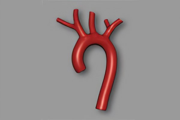 аорта аорта