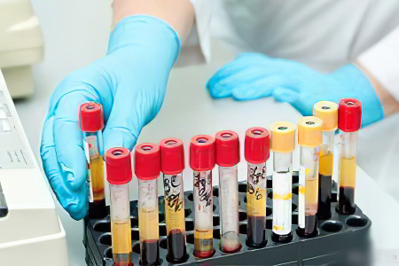 Аспартатаминотрансфераза Аспартатаминотрансфераза