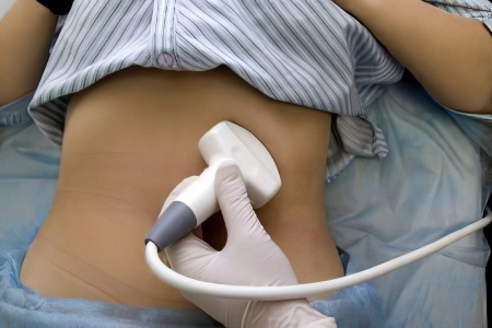 Диагностика атеросклероза брюшной аорты Диагностика атеросклероза брюшной аорты