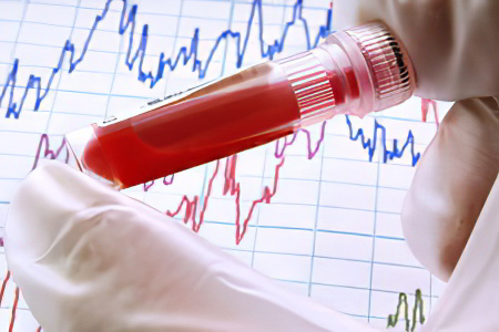 Билирубин прямой Билирубин прямой