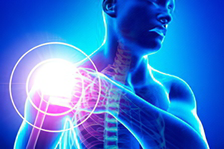 Боль в плечевом суставе Боль в плечевом суставе