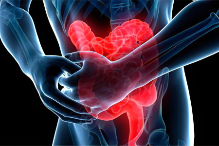 Боль при патологиях толстого кишечника Боль при патологиях толстого кишечника