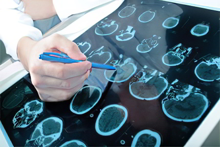 Диагностика болезни Паркинсона Диагностика болезни Паркинсона