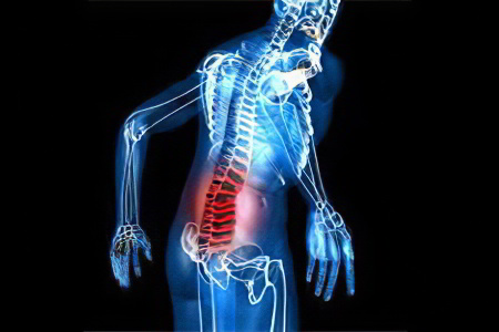 Если утром болит поясница Если утром болит поясница