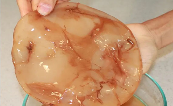 Бурые пятна на грибе Бурые пятна на грибе