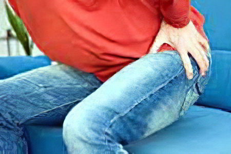 Дермоидная киста копчика Дермоидная киста копчика