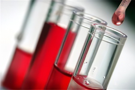 Диагностика атеросклероза коронарных артерий Диагностика атеросклероза коронарных артерий