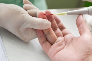 Диагностика лимфопении Диагностика лимфопении