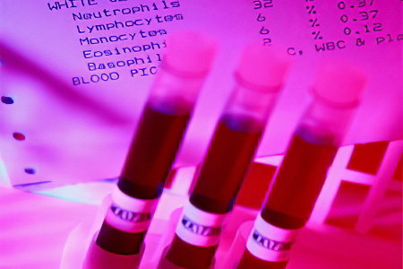 Диагностика постгеморрагической анемии Диагностика постгеморрагической анемии