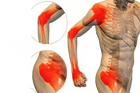 Симптомы поражения других органов Симптомы поражения других органов