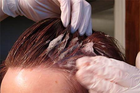 Другие способы лечения педикулеза Другие способы лечения педикулеза