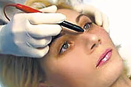 Электрокоагуляция Электрокоагуляция