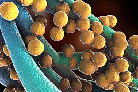 эпидермальный стафилококк эпидермальный стафилококк