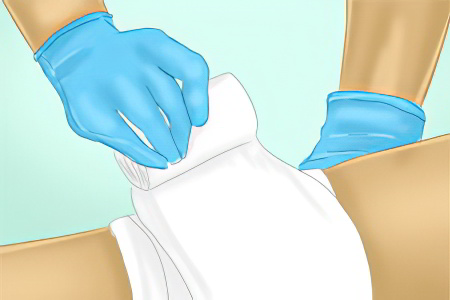 Этапы лечения открытых ран Этапы лечения открытых ран