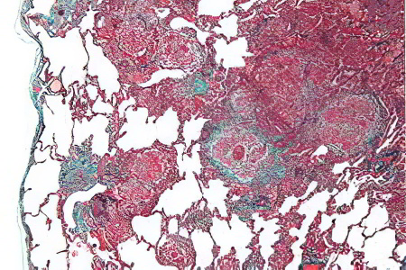 Этиология Этиология