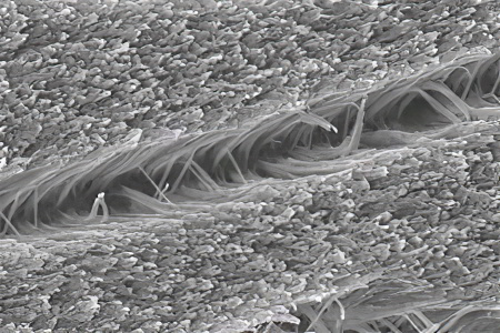 Фазы срастания переломов Фазы срастания переломов