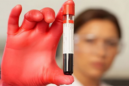 Фосфор Фосфор