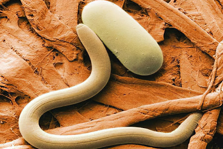 Гельминтозы Гельминтозы