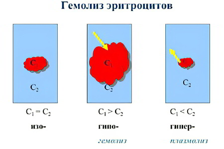 Где происходит гемолиз Где происходит гемолиз
