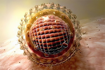 Гепатит A Гепатит A