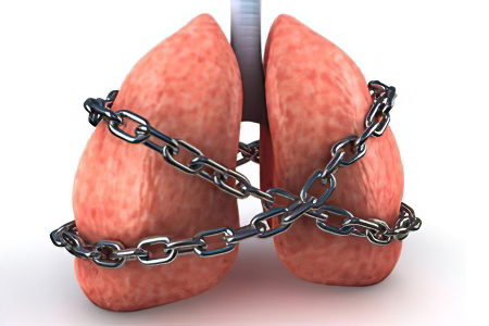 Причины и симптомы гипоксемии Причины и симптомы гипоксемии