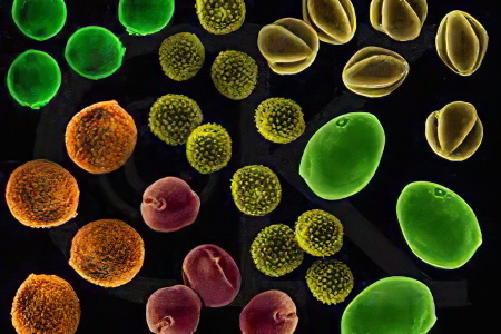 Гистологическая картина Гистологическая картина