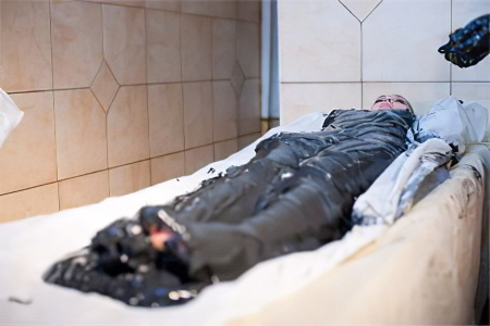 грязелечение грязелечение