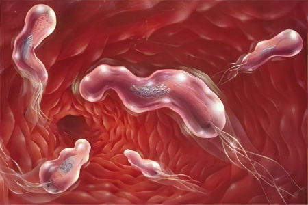 Полипы в желудке Полипы в желудке