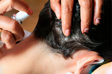 Химические препараты Химические препараты