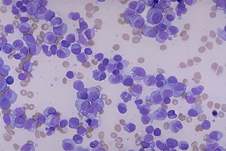 Причины боли в левом боку Причины боли в левом боку