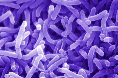 холера холера