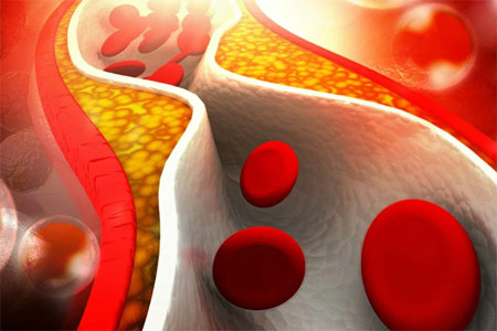 Снижает уровень холестерина Снижает уровень холестерина