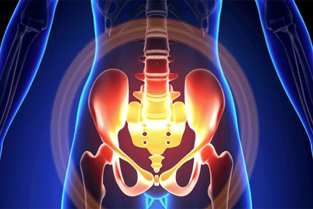 Хроническая тазовая боль Хроническая тазовая боль