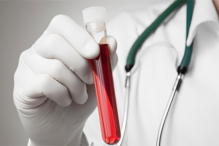 Как обнаружить пернициозную анемию Как обнаружить пернициозную анемию