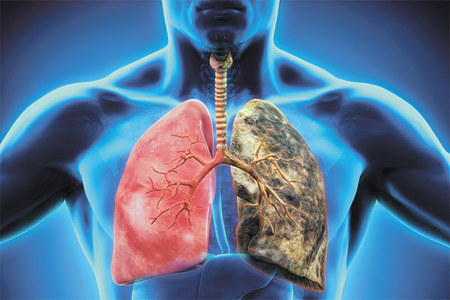 Осложнения Осложнения