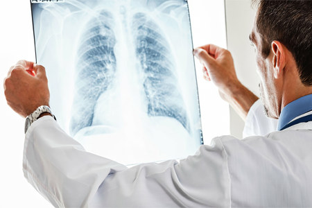 поражены лёгкие при коронавирусе поражены лёгкие при коронавирусе