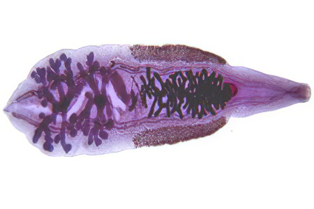 Сосальщик китайский Сосальщик китайский