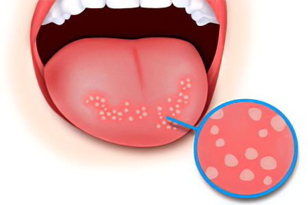 Классификация заболевания Классификация заболевания