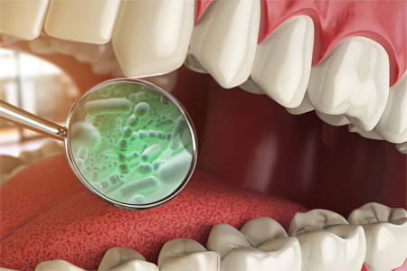 Классификация заболеваний СОПР Классификация заболеваний СОПР