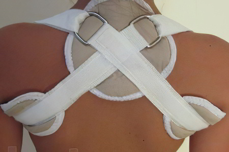 Кольца Дельбе Кольца Дельбе