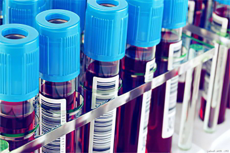 Креатинкиназа Креатинкиназа