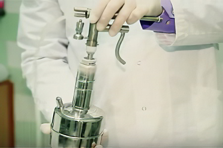 Криодеструкция сухой мозоли