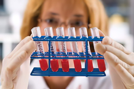 Лечение повышенного билирубина Лечение повышенного билирубина