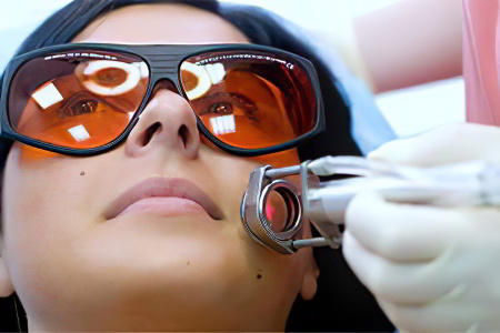 Как убрать сосудистые звездочки на лице Как убрать сосудистые звездочки на лице