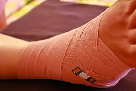 Лечение вывиха ноги Лечение вывиха ноги